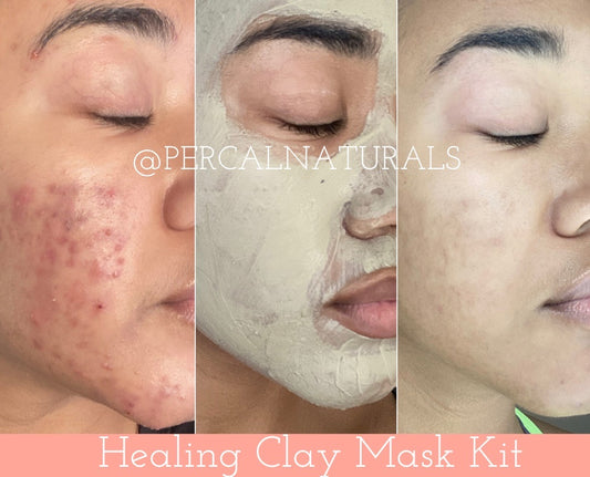 What Is Bentonite Clay & Why Is It So Effective In Treating Acne