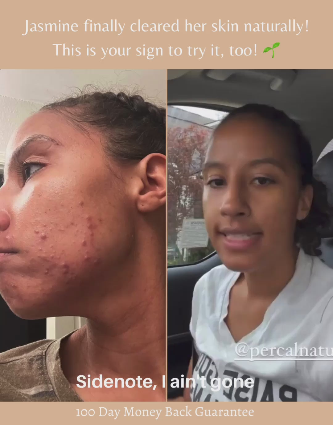 Complete Natural Acne Routine
